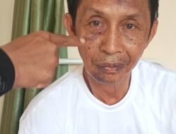 Seorang Wartawan Media Online Lintas Media Laporkan Peristiwa Pemukulan Dirinya ke Polsek Padang Cermin