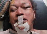 Nico Saragih Jurnalis Media Online Medan Ditemukan Tewas, Diduga Korban Pembunuhan